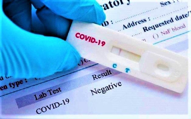 Invima advierte sobre publicidad de pruebas fraudulentas para la deteccion del covid 19