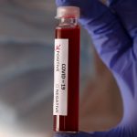 Primer caso de Coronavirus en San juan de Rioseco