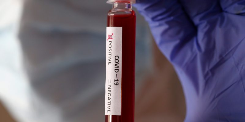 Primer caso de Coronavirus en San juan de Rioseco