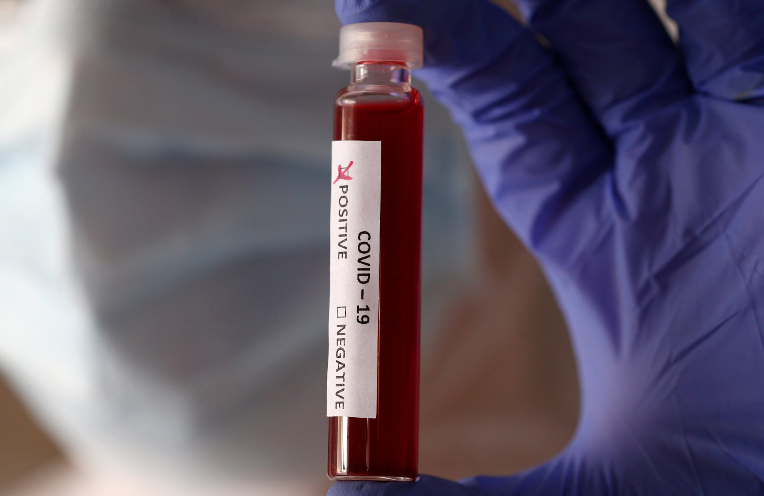 Primer caso de Coronavirus en San juan de Rioseco