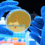 Confirman tres casos de viruela simica del mono en Colombia