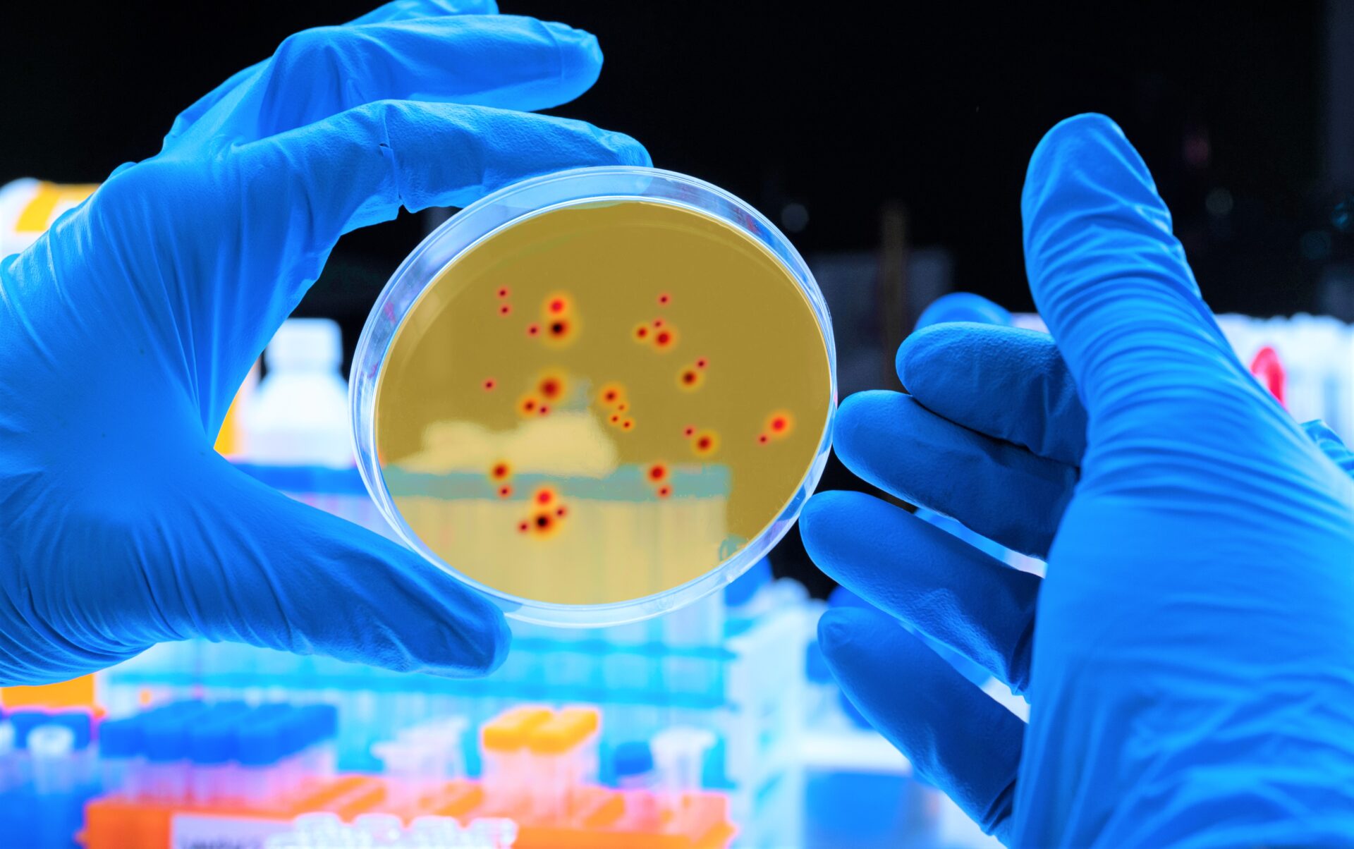 Confirman tres casos de viruela simica del mono en Colombia