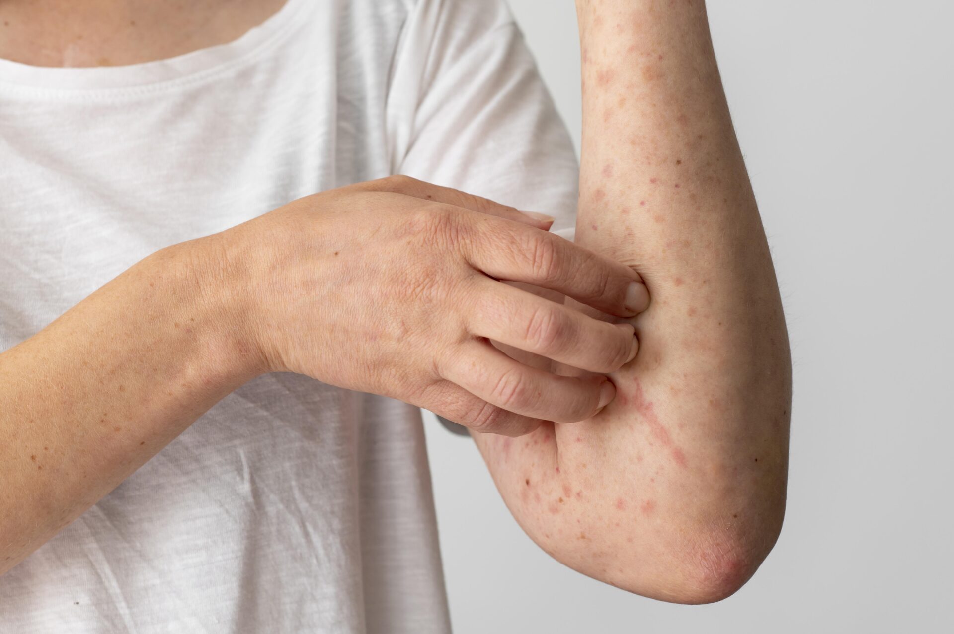 skin allergy reaction on person s arm
