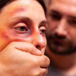 close upf woman with bruises 2023 11 27 05 05 09 utc