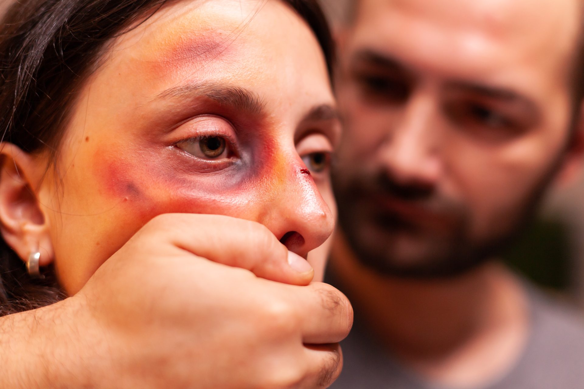 close upf woman with bruises 2023 11 27 05 05 09 utc
