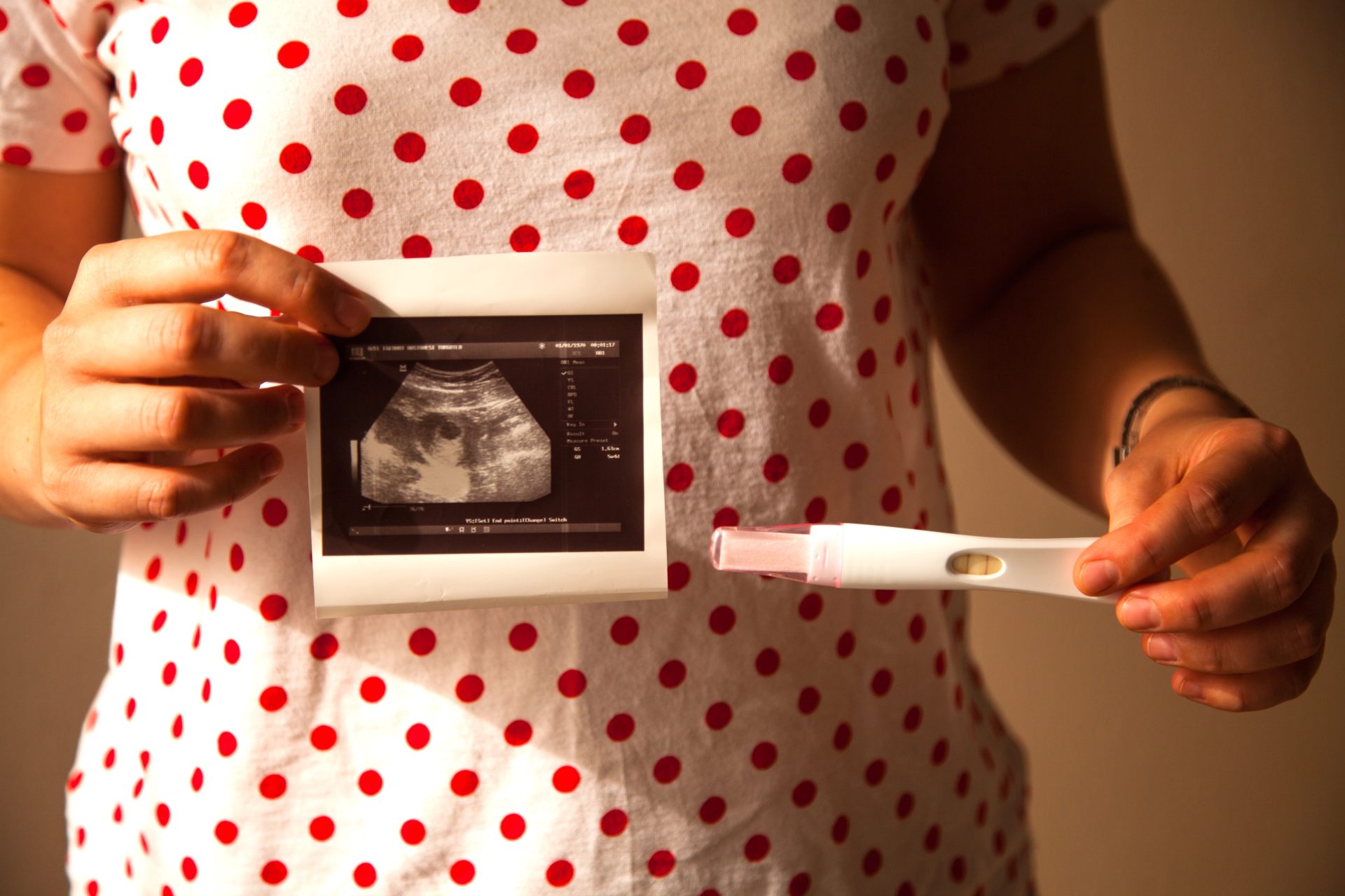 Chia se unio a la Semana Andina para prevenir el embarazo adolescente1