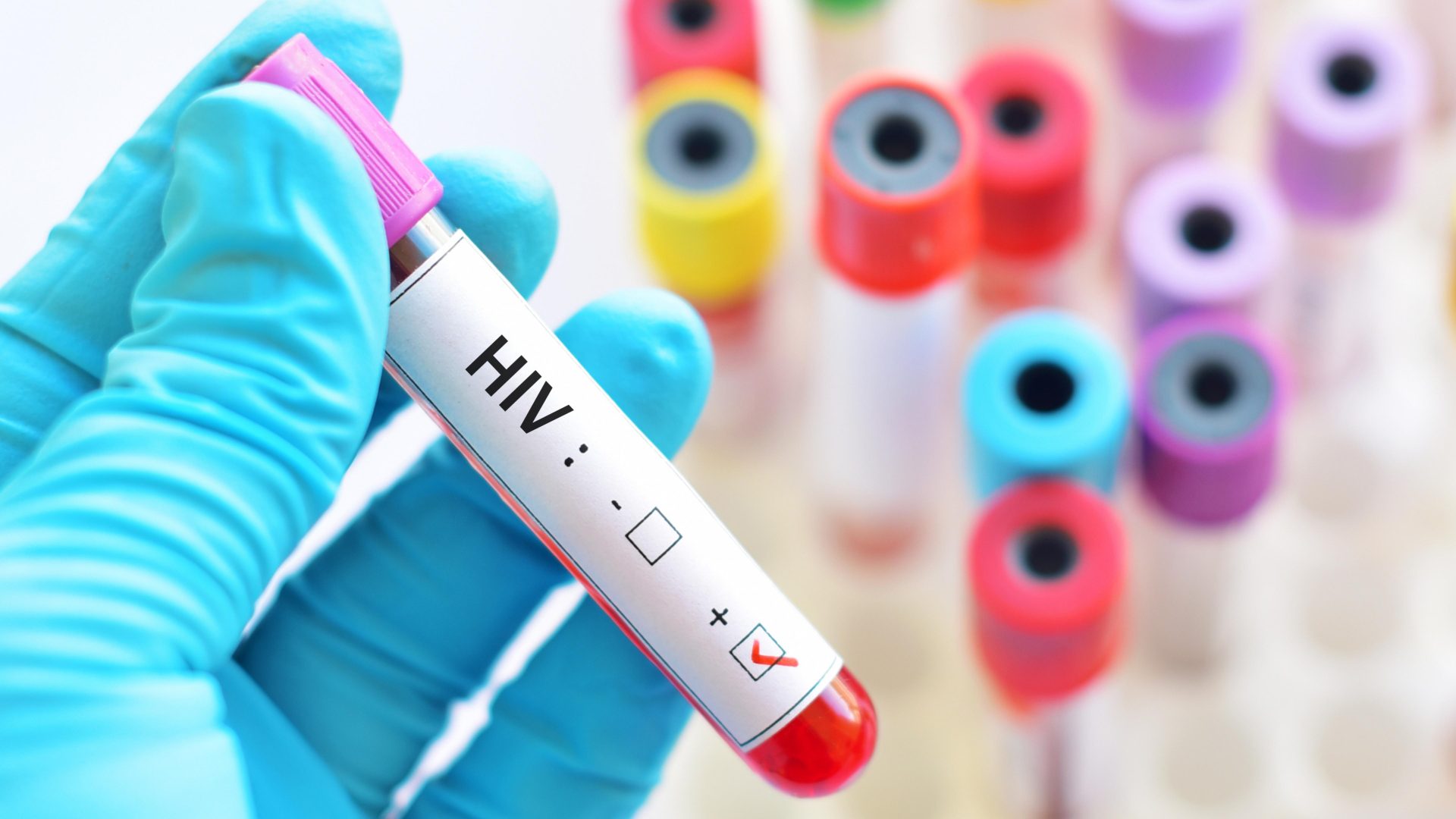 hiv virus medical concept human immunodeficiency 2023 11 27 05 15 42 utc