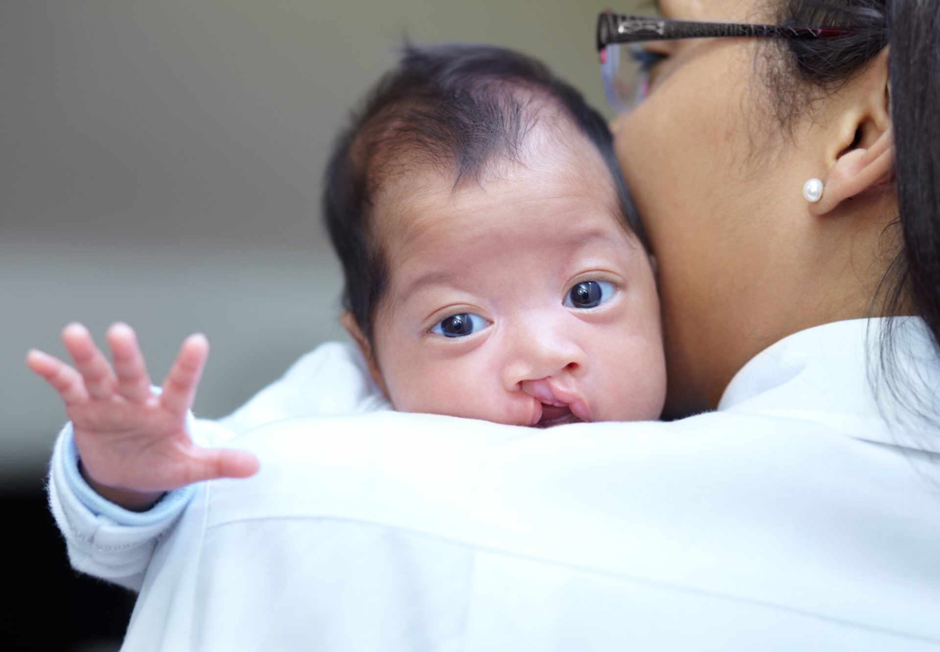 portrait of a baby girl who has a cleft palate loo 2023 11 27 04 53 49 utc