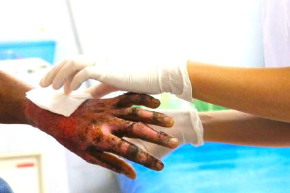 Polvora deja 41 lesionados en Cundinamarca 11 son menores1