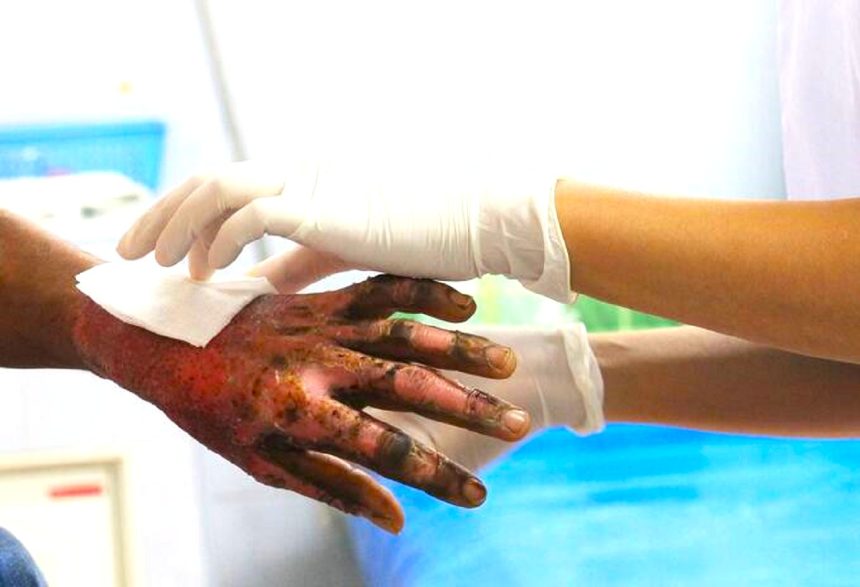 Polvora deja 41 lesionados en Cundinamarca 11 son menores1