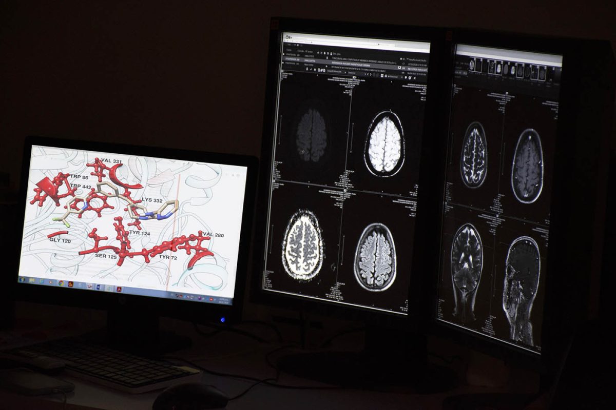 Identifican tres moléculas con potencial para tratar el Alzheimer mediante simulaciones computacionales